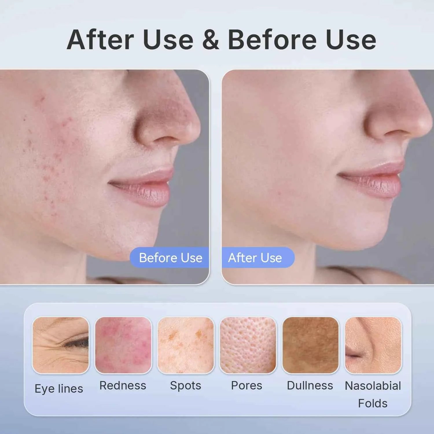 Wireless Near-Infrared and Red Light Therapy Facial Mask