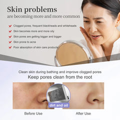 Ultrasonic Skin Scrubber & EMS Facial Lifting Device