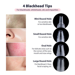 Diamond Microdermabrasion Machine – 3 in 1 Facial Peeling, Deep Clean & Skin Rejuvenation Device
