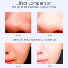 Ultrasonic Skin Scrubber – Deep Clean, Hydrate & Lift Facial Device