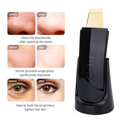 Ultrasonic Skin Scrubber – Deep Clean, Hydrate & Lift Facial Device