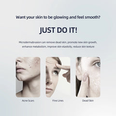 Diamond Microdermabrasion Machine – 3 in 1 Facial Peeling, Deep Clean & Skin Rejuvenation Device
