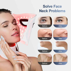 Silicone LED Face & Neck Mask – 7 Color Wireless Photon Light Therapy Device