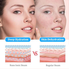 Portable Diamond Microdermabrasion Blackhead Remover & Skin Renewal