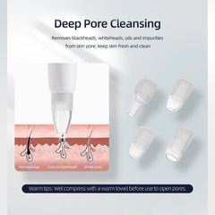 Diamond Microdermabrasion Machine – 3 in 1 Facial Peeling, Deep Clean & Skin Rejuvenation Device