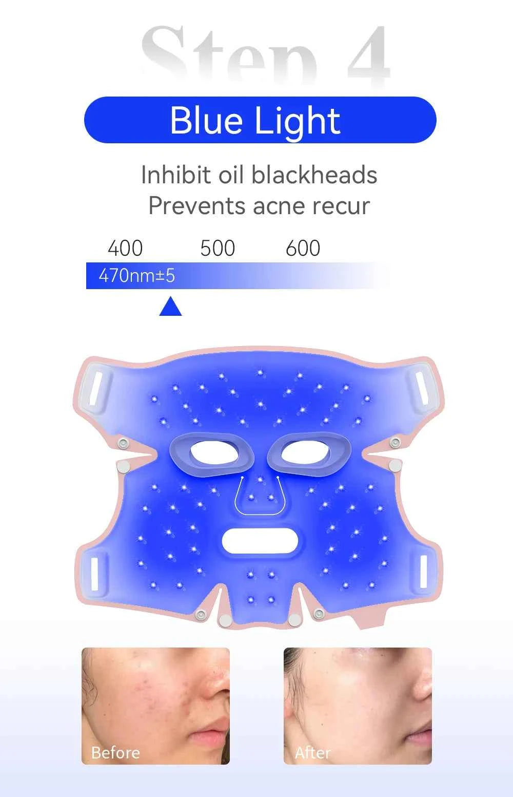 5-Color LED Face Mask – Photon Light Therapy Skin Rejuvenation Device with Heat Function
