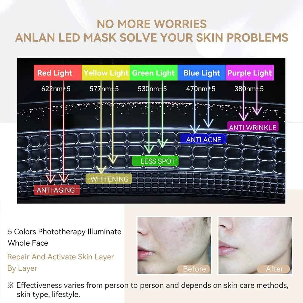 5-Color LED Face Mask – Photon Light Therapy Skin Rejuvenation Device with Heat Function