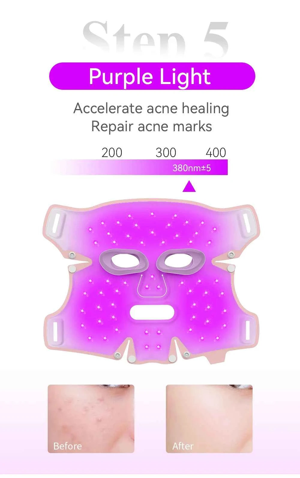 5-Color LED Face Mask – Photon Light Therapy Skin Rejuvenation Device with Heat Function